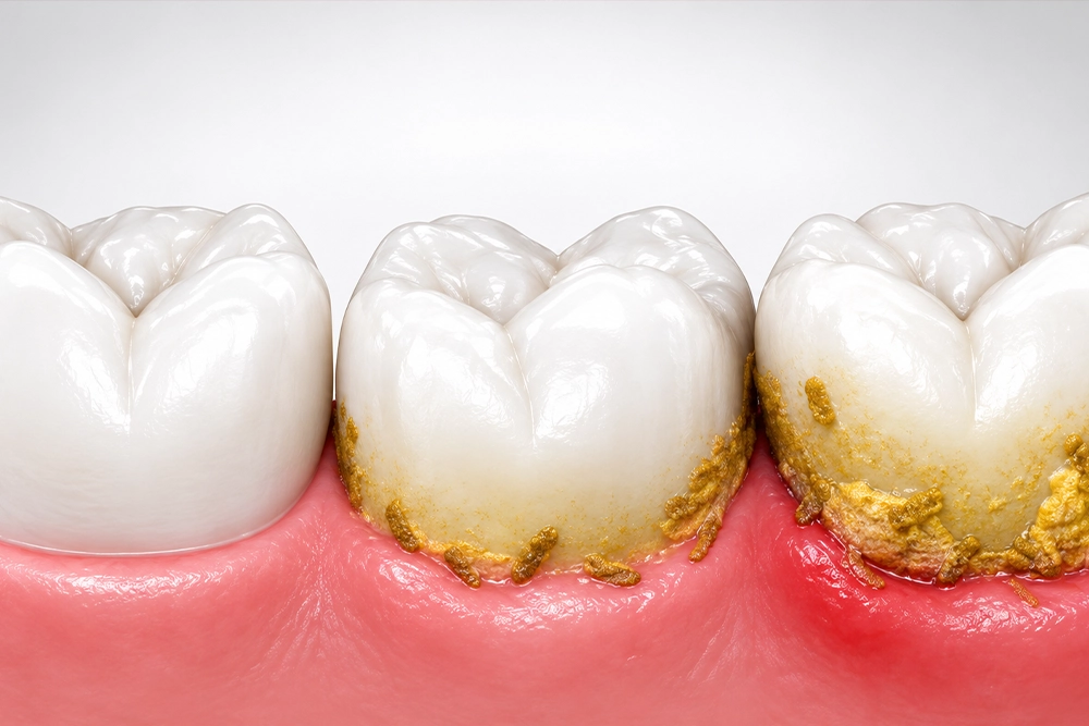 Periodontoloji Nedir?