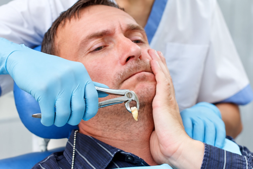 What is Tooth Extraction?