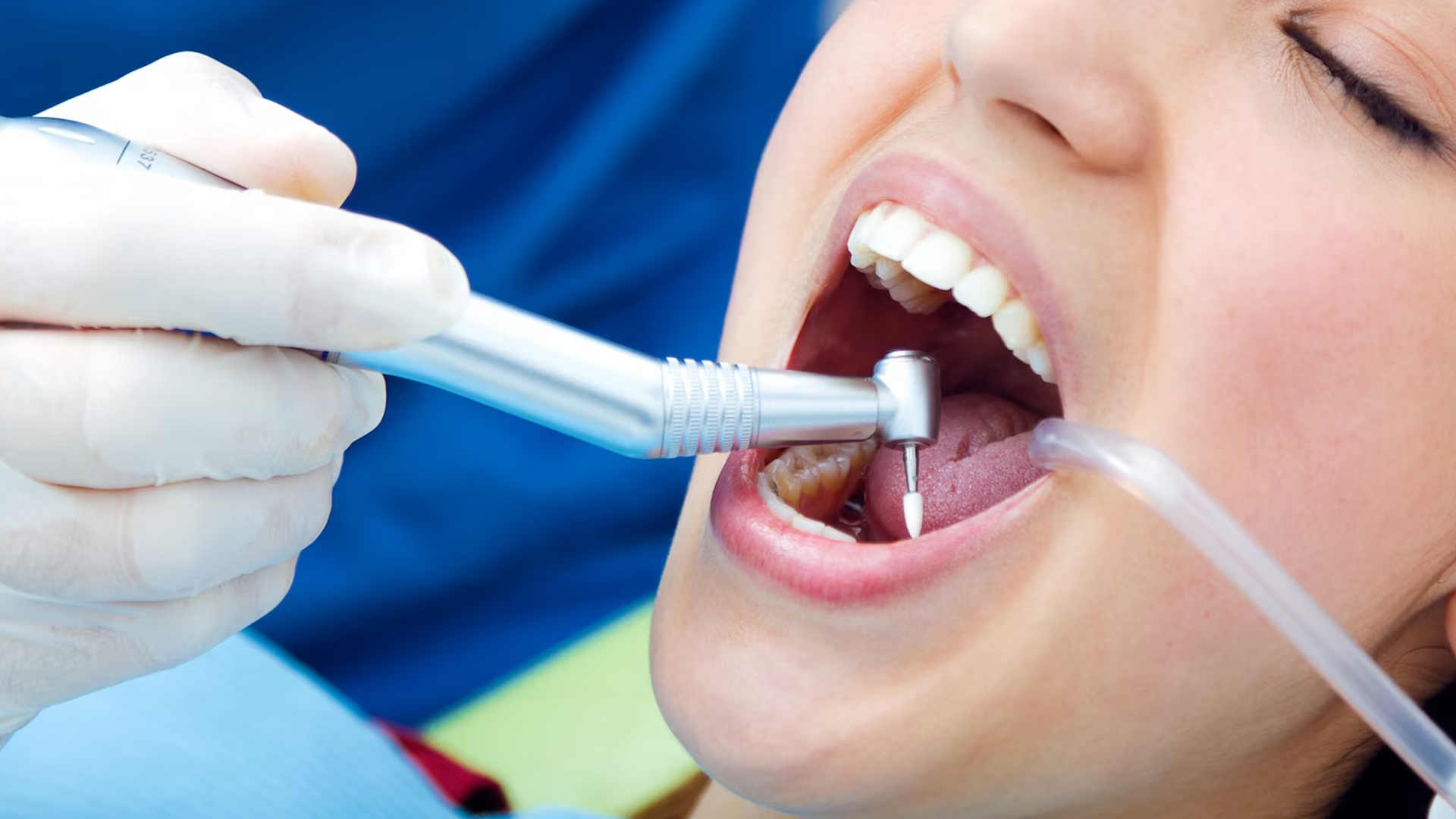Endodonti (Kanal Tedavisi)