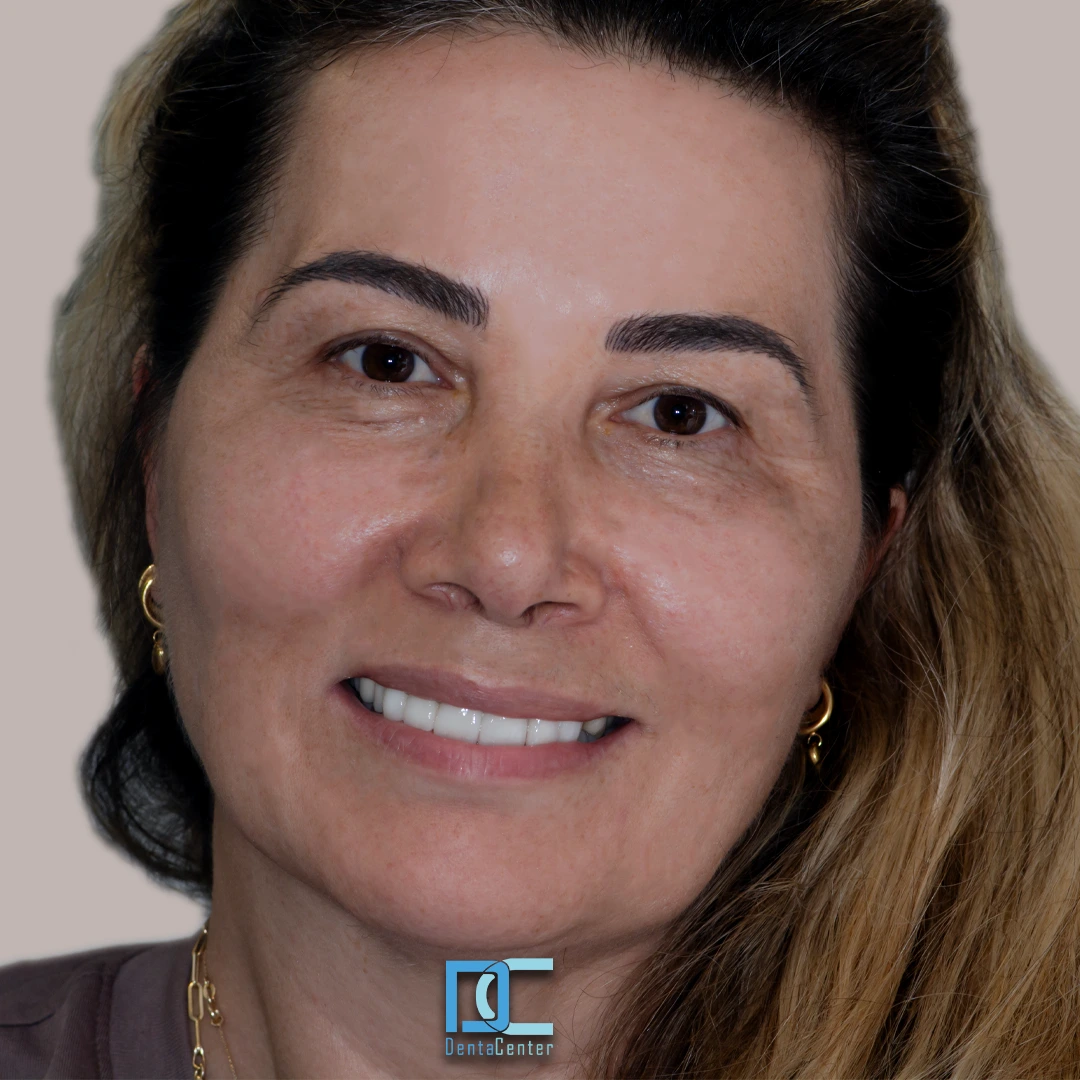 DentaCenter tanıtım görseli 3