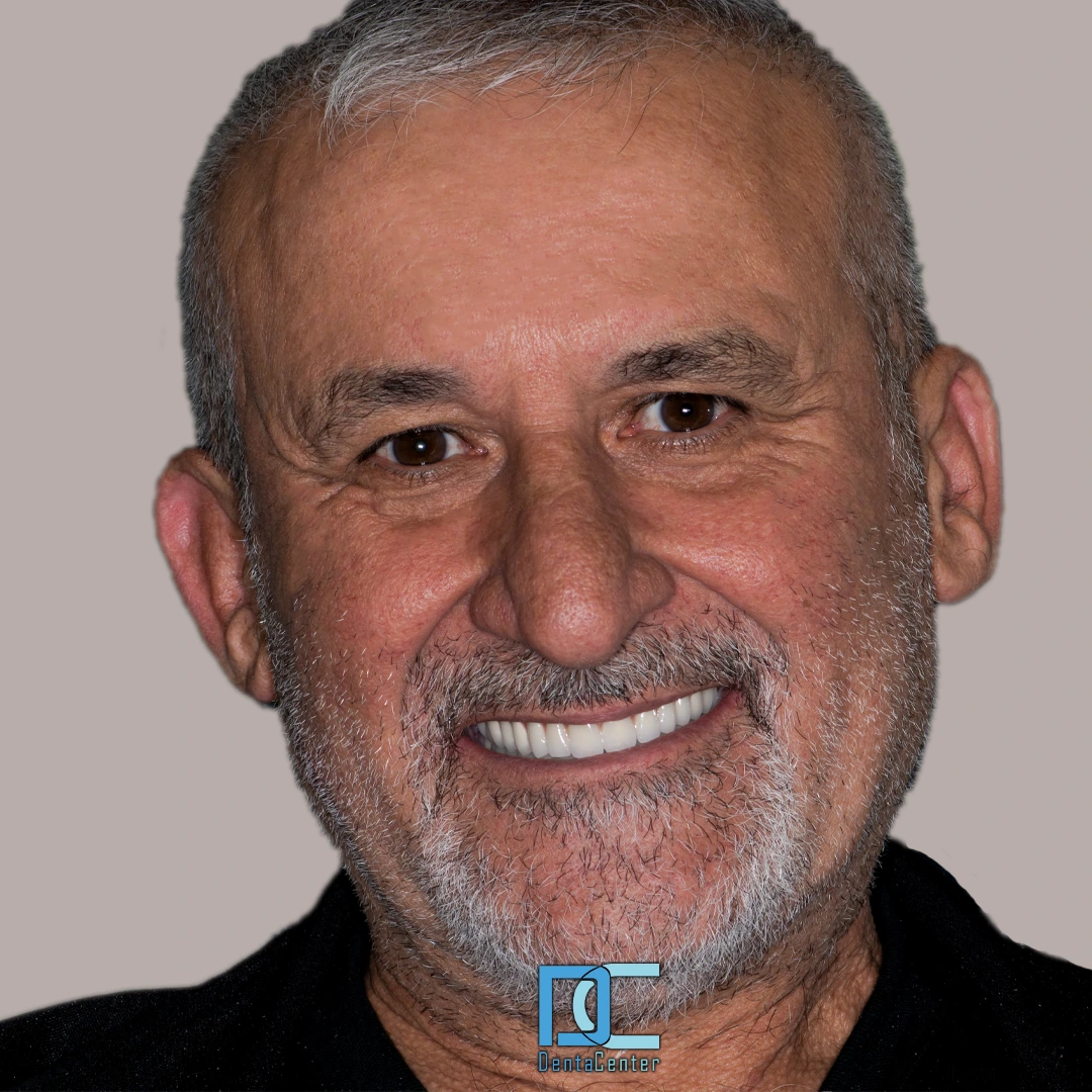 DentaCenter tanıtım görseli 1
