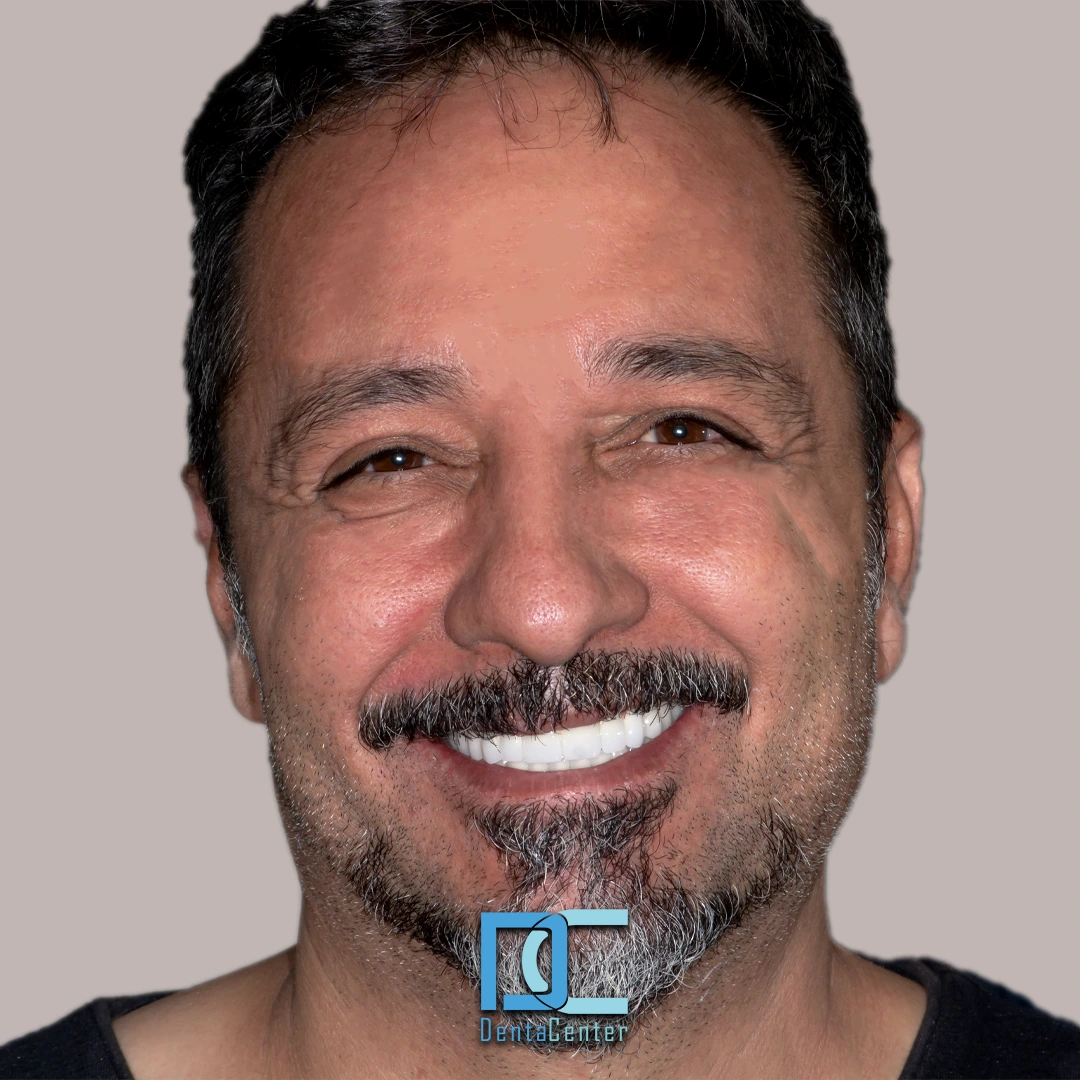 DentaCenter tanıtım görseli 4